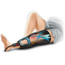 Load image into Gallery viewer, Game Ready Knee Wrap (Straight or Articulated)